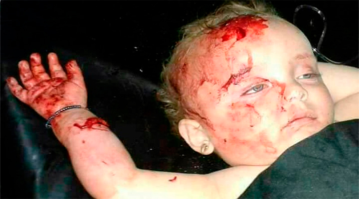 ШАМ. Ожесточенные бои в Хама, на юге Алеппо и в Восточной Гуте. Русские убивают сирийских детей